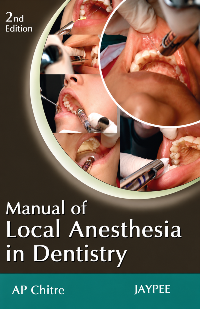 Manual Of Local Anesthesia In Dentistry, 2 E ( 2010)