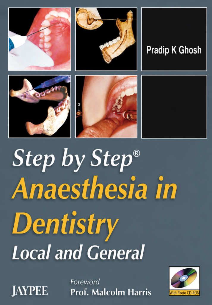 Step by Step Anaesthesia in Dentistry by Ghosh 2 Step by Step Anaesthesia in Dentistry' by Ghosh